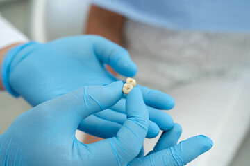 dentist holds an implant and consults an elderly woman with the installation of a tooth crown,...