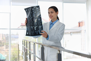 Doctor examining brain MRI scan in hospital