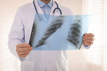 Doctor examining lung MRI scan in clinic, closeup