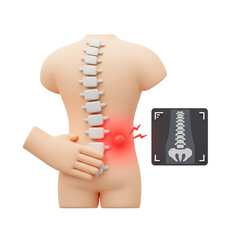 3d Illustration Lower Back Pain Relief Concept with Medical Scan of Spine