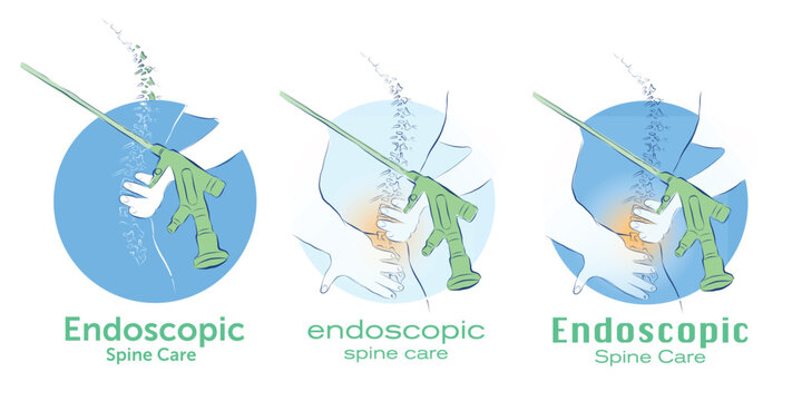Vector Illustration of Endoscopic Spine Care Logo Design in Simple Line Art Style on White Background
