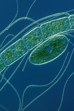 Microscopic image of a mixed sample showing cyanobacterium Anabaena sp. and green algae Netrium and Zygnema sp.