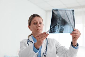Doctor examining neck MRI scan in hospital