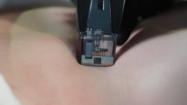 Close-up of micro needling procedure on skin using advanced cosmetic device, focus on needle cartridge penetrating the surface for collagen stimulation
