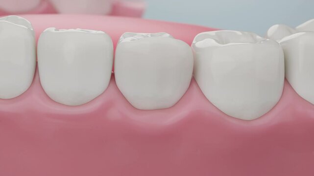 Inflamed gums recover and reattach after effective treatment