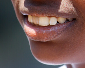 A woman's mouth is open, revealing her teeth