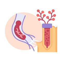 Arterial Blood Gas Test Illustration on Black Background