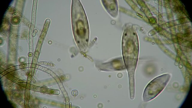 Microscopic life: Trachelomonas algae and filamentous green algae in water, magnified view.