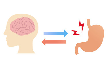 ストレスで胃が痛くなる仕組み、胃脳相関と機能性ディスペプシアの概念図。