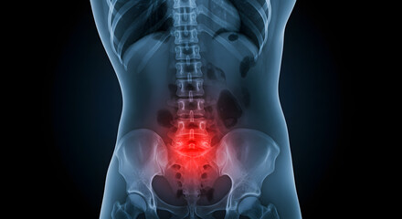 Lower Back Pain: X-Ray Style Anatomical Illustration with Red Pain Point