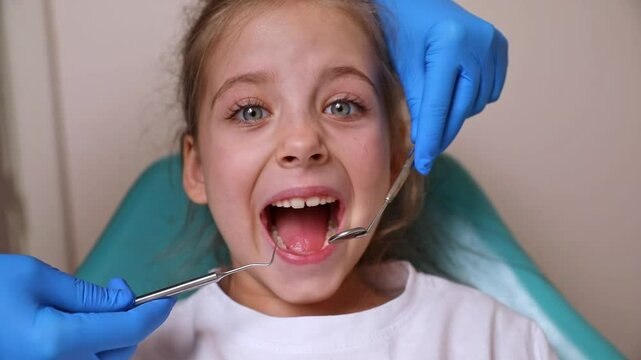 Close up dentist, doctor examines the oral cavity of a little girl, uses a mouth mirror, baby teeth close-up, the concept of pediatric dentistry, dental treatment.
