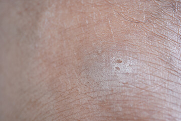 closeup of dry skin texture 