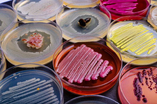 Multiple Bacterial Cultures Displaying Diverse 