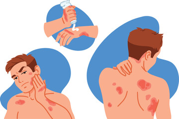 Stressed man with allergic itching, skin inflammation, redness and irritation. Upset guy suffer from itchiness and redness. Atopic dermatitis, eczema, psoriasis, dry skin. Skin diseases set. 