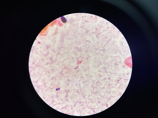 gram negative bacilli in hemoculture.