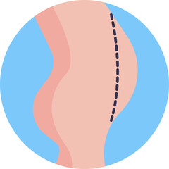 Fat Removal Procedure: Icon representing liposuction, a cosmetic surgery that removes excess fat from specific body areas through suction.