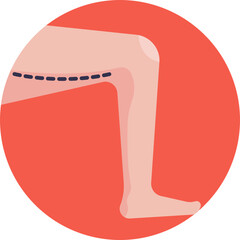 Leg Reconstruction: Represents procedures that restore or enhance the leg's appearance and functionality after injury or congenital defects.