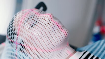 A young woman wearing an immobilization mask undergoes computed tomography before radiation therapy. Concepcion of diagnostics and therapy of cancer patients.