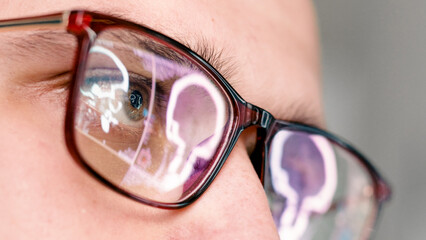 The doctor is reading the MRI scans. The glasses reflect the results. The concept of modern...