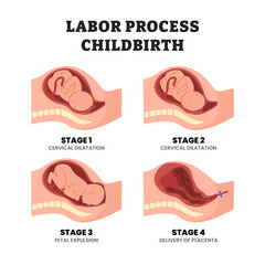 Stages of labor or childbirth process stages, educational medical poster design healthcare scheme, labeled cervical dilatation, fetal expulsion, delivery of placenta. Fetal movement during the labor.
