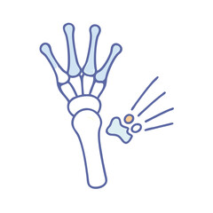 Human hand bone structure with exploded joint representation