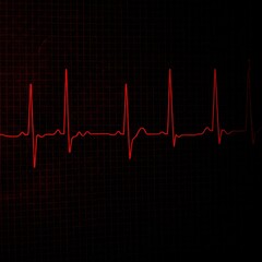 heart beat cardiogram