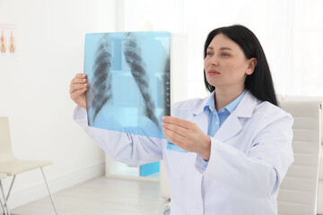 Doctor examining lung MRI scan in clinic