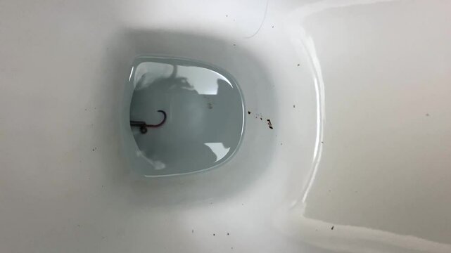 live helminths in home toilet moving in water