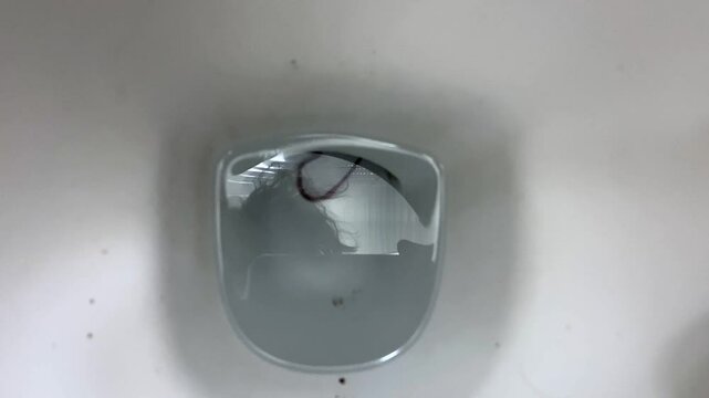 live helminths in home toilet moving in water