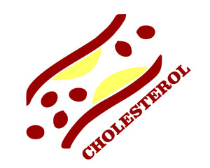 a cholesterol human body vein with blood cell stream