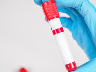 A close-up of a blood collection container, ready for medical testing. Sterile and professional.