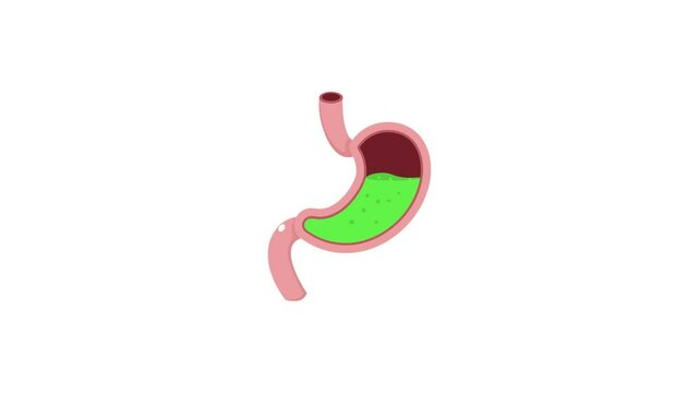 Acid Reflux  Animation. Stomach digestive problem on white background.