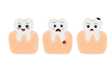 Vector illustration of three cartoon teeth showing different oral health conditions: healthy tooth, tooth with cavity and tooth with caries. Cute and educational dental care concept. Flat style.