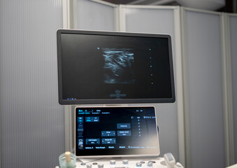 Modern ultrasound machine displaying sonogram images in hospital room