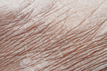 Detailed close-up of textured skin revealing age and characteristics