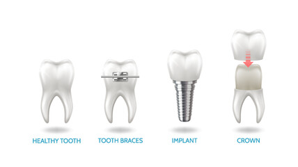 realism-set-teeth-different-types-dental-problems