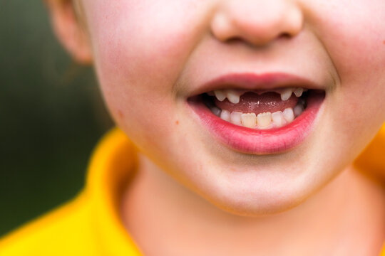 Young school girl showing her missing front teeth