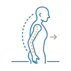 Forward Head Posture Illustration: Correcting and Managing Neck and Back Pain