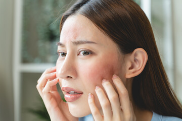 Sensitive skin with cosmetology, Asian young woman looking at red spot on her face from cosmetic allergy in the mirror.