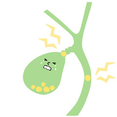 胆石のある胆嚢のイラスト