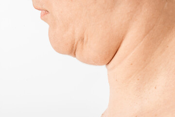 Fototapeta premium Neck and double chin of a middle-aged woman. Weakened muscles, sagging skin due to loss of collagen in the skin and wrinkles.