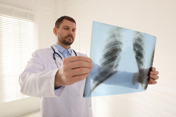 Doctor examining lung MRI scan in clinic