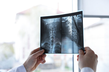 Doctor examining neck MRI scan on blurred background, closeup