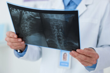 Doctor examining MRI scan in hospital, closeup