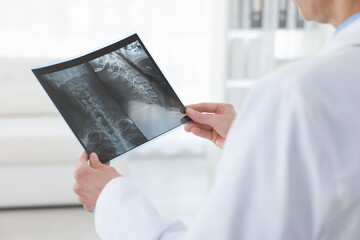 Doctor examining MRI scan in hospital, closeup