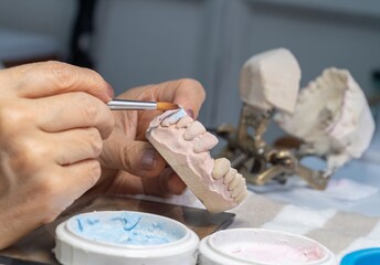 Close-up of a dental technician’s hands made a dental model with precision, showcasing artistry and professional expertise