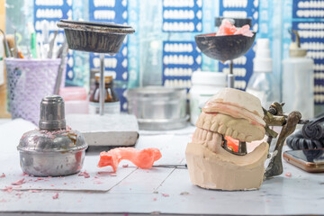 A dental laboratory featuring tools, molds, and materials used for prosthetics creation. A vivid glimpse into the precision of dental artistry