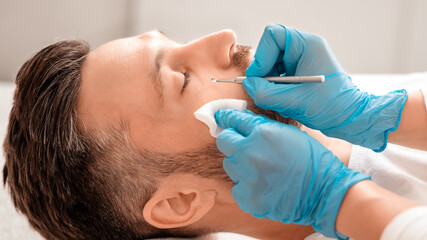 Male cosmetology concept. Unrecognizable cosmetician using blackhead remover for cleaning middle...