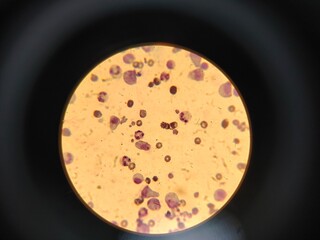 bacteria and microbes under a microscope