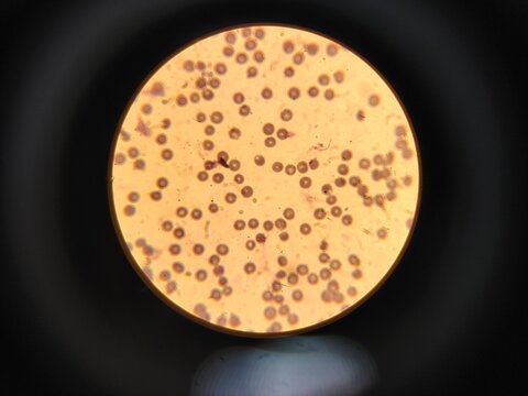 bacteria and microbes under a microscope